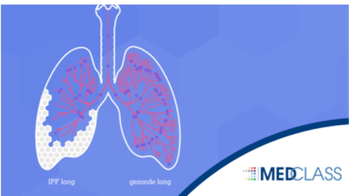 On demand nascholingen