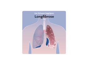 Pocket Doctor PF-ILD/PPF