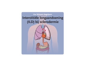 Pocket Doctor  CTD-ILD