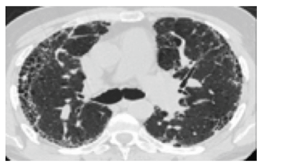 Diagnostische voorgeschiedenis