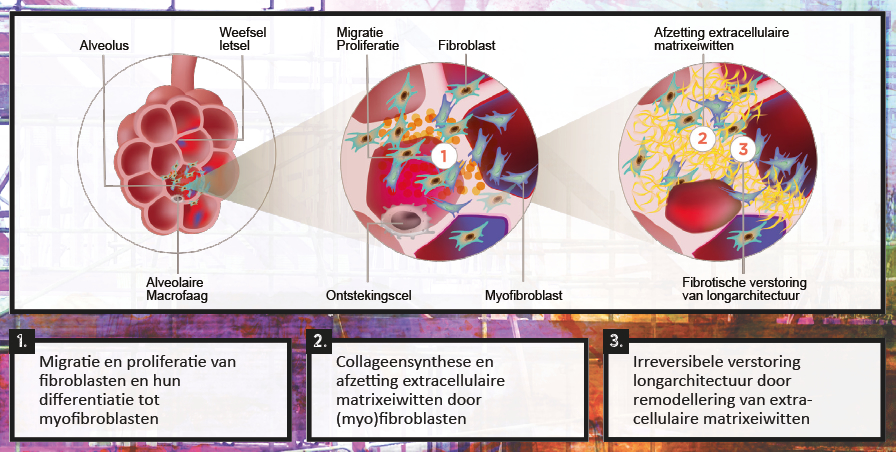 Fibrosevorming bij ILD