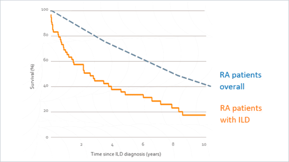 Wetenswaardigheden RA-ILD