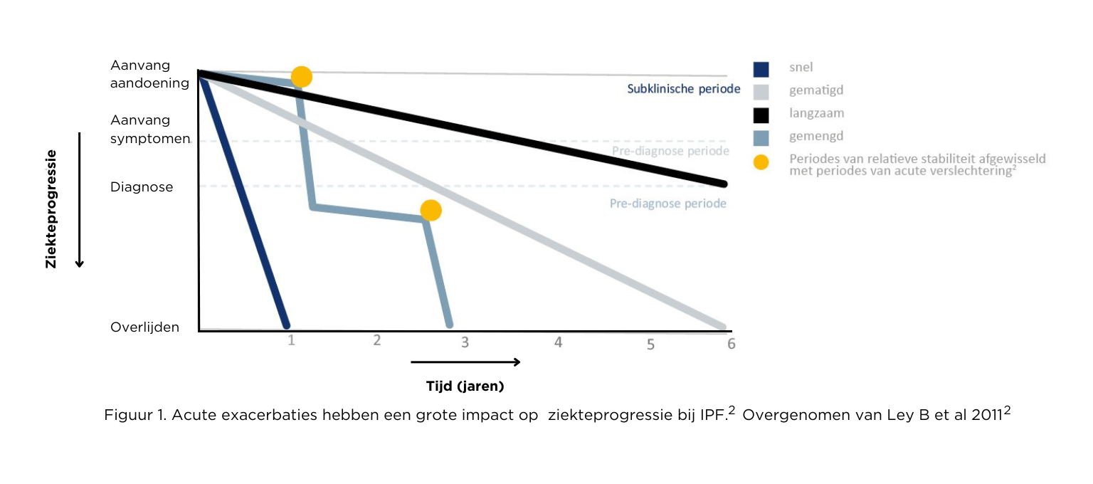 Impact van acute exacerbaties op ziekteprogressie bij IPF