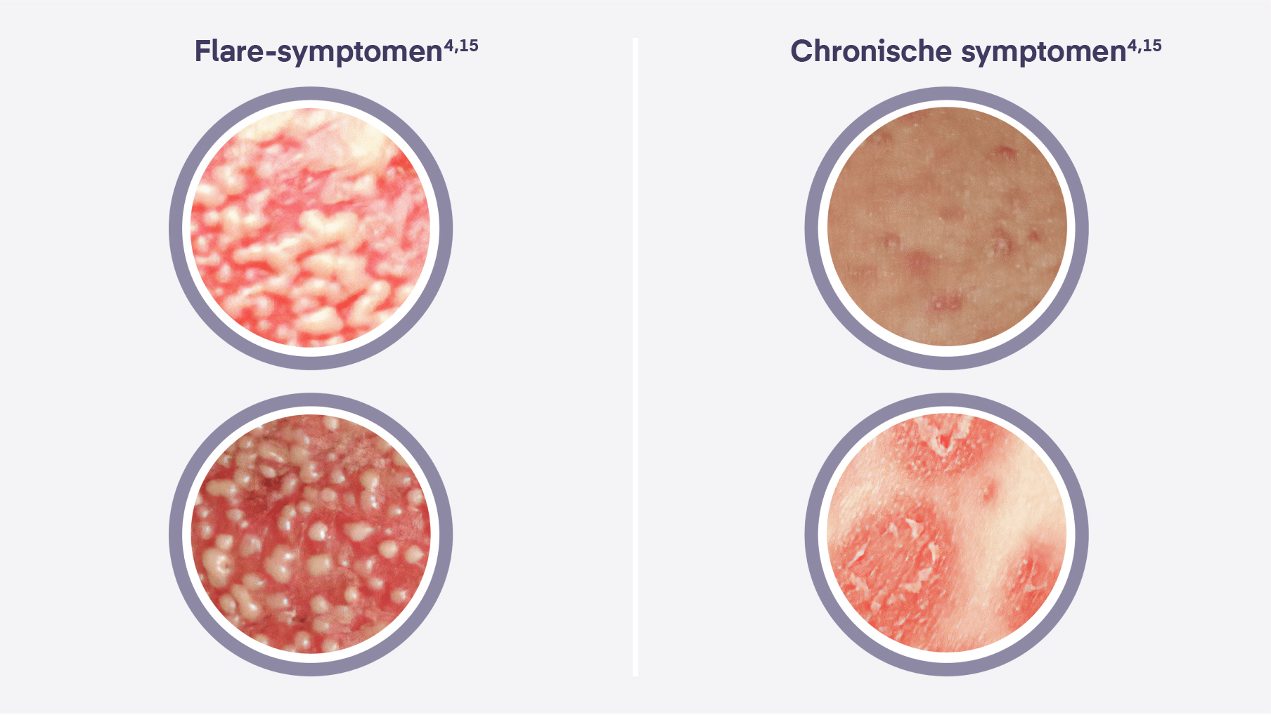 GPP is onvoorspelbaar en zeer heterogeen